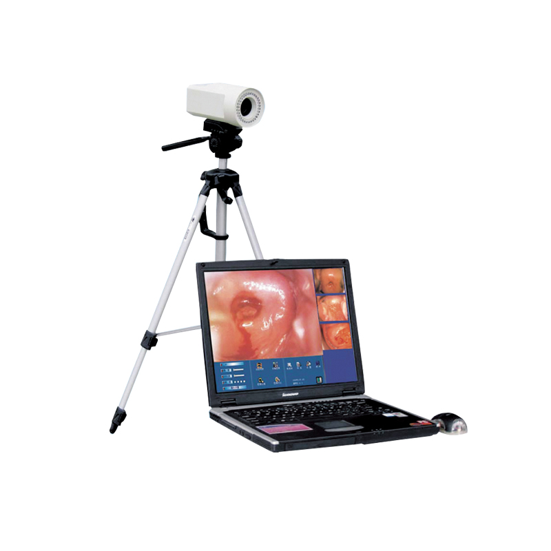 信达XINDA  电子阴道镜工作站 XD-6000Y (便携式)