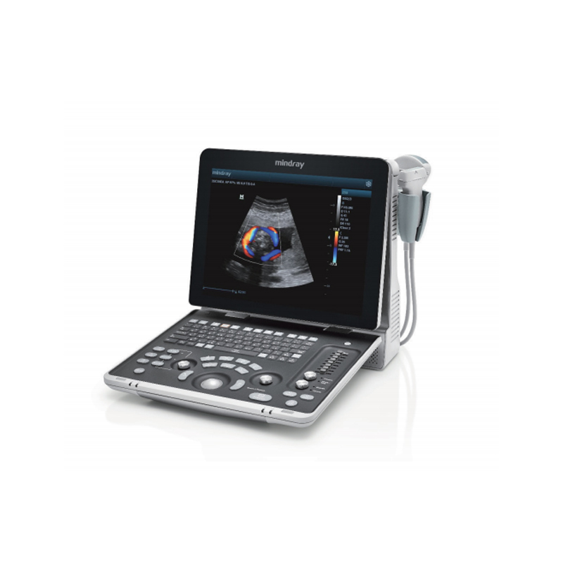 迈瑞 Mindray 便携式彩色多普勒超声系统 Z50BW