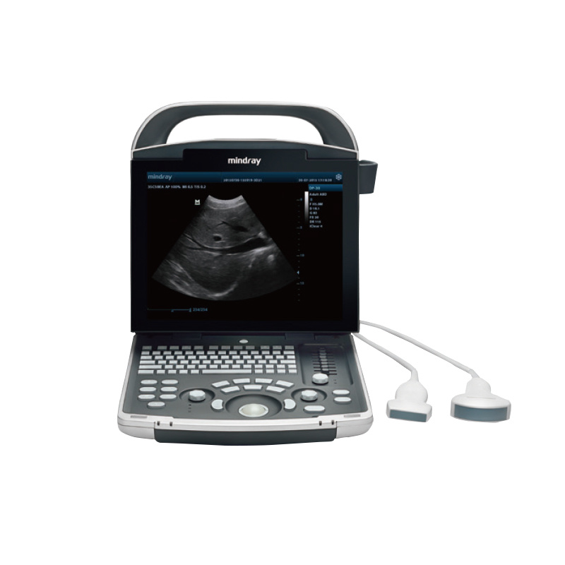 迈瑞Mindray 全数字便携式超声诊断系统 DP-30