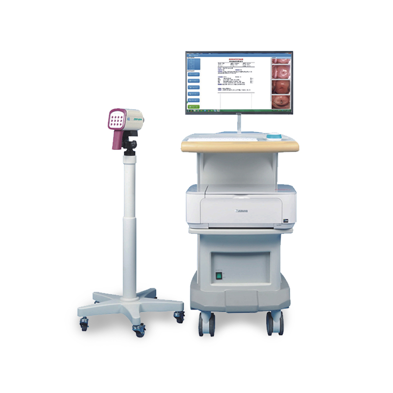 正丰元Zeefly 数字阴道镜 A3