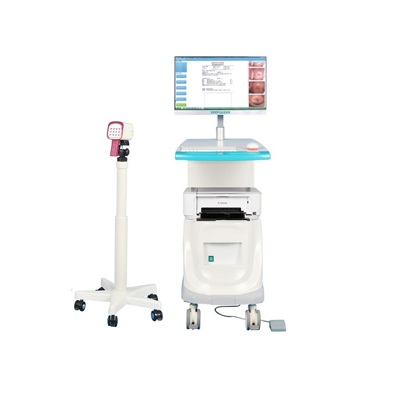 正丰元Zeefly 数字阴道镜 A6