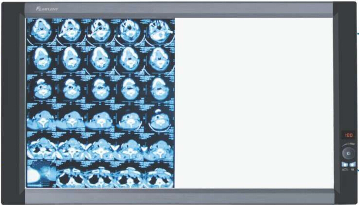 兆丰光电MPLENT X射线胶片观片灯 ZG-1B