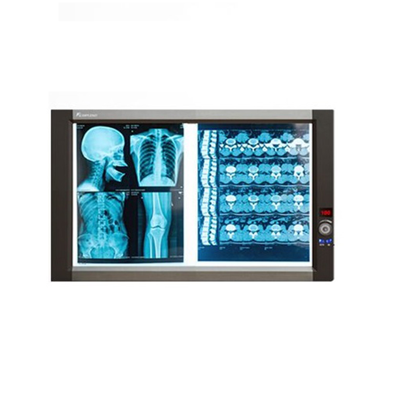 兆丰光电MPLENT  X射线胶片观片灯 ZG-2B